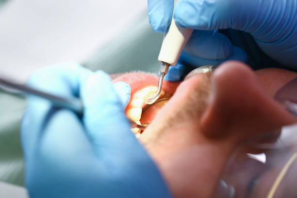 Best Emergency Dental Care for Trauma or Injury in Wilburton, OK