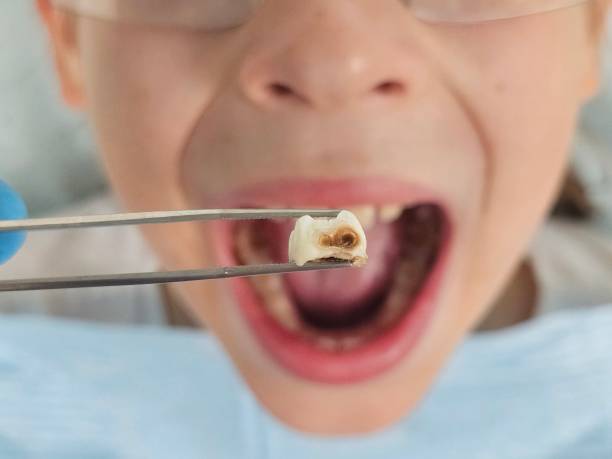 Best 24-Hour Emergency Dentist in Wilburton, OK